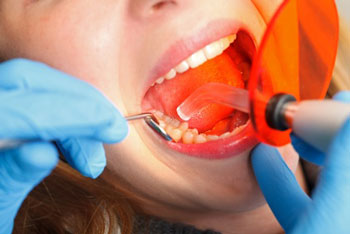 restorative-dentistry-in-sugarland